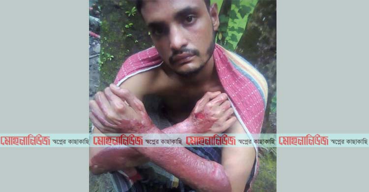 সিলিন্ডার বিস্ফোরণ: সহযোগীতা পেলে সুস্থ হবেন কাউছার