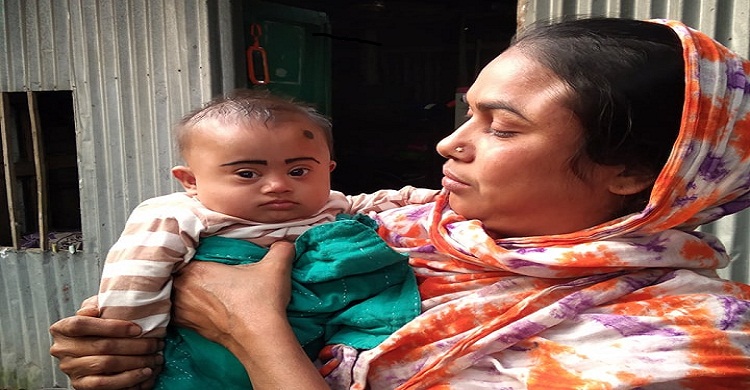 বিত্তবানদের আর্থিক সহযোগীতায় বাঁচতে পারে ফুটফুটে রিমি
