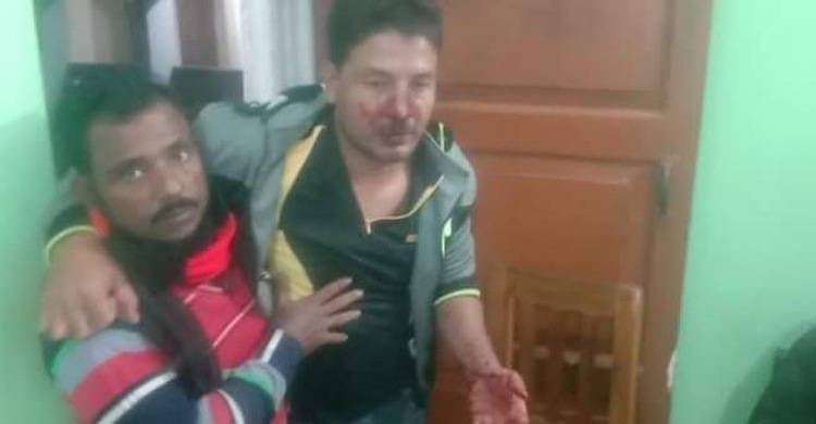 রামগতিতে বাবা-ছেলের মারামারির সমাধান করায় শ্রমিকলীগ নেতা রক্তাক্ত