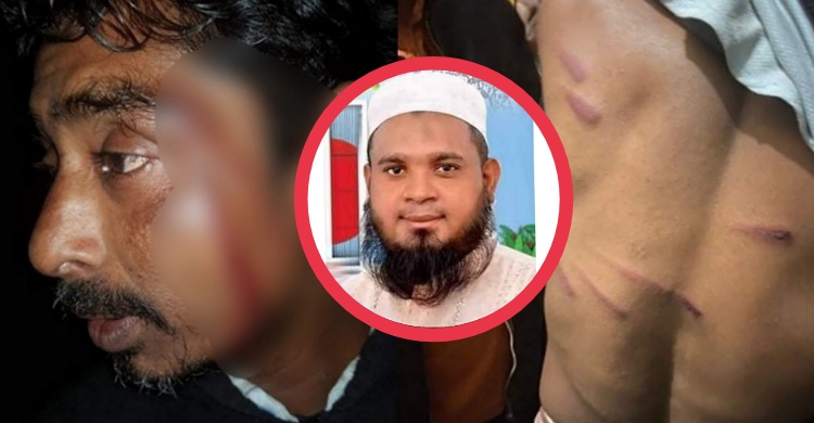লক্ষ্মীপুরে ‘গরম কাউন্সিলর’ সুমনের পিটুনিতে দুই শ্রমিক হাসপাতালে
