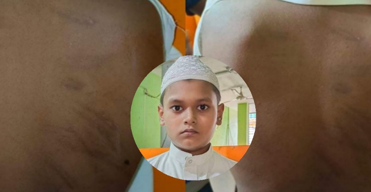 লক্ষ্মীপুরে ছাত্রকে বেদম পিটিয়েও ক্ষান্ত হননি শিক্ষক, মুখ খুললেই ফের মারার হুমকি