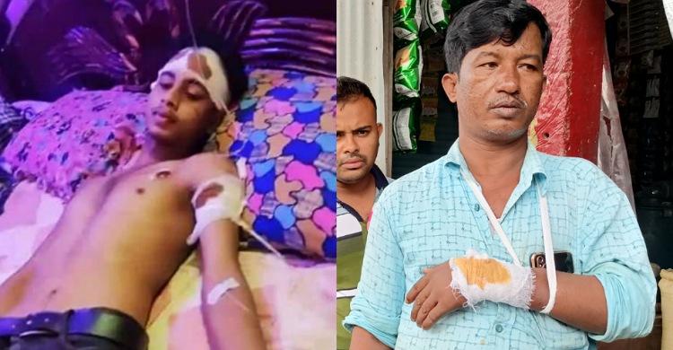লক্ষ্মীপুরে ছাত্রলীগ-যুবদলের মারামারিতে আহত ৪