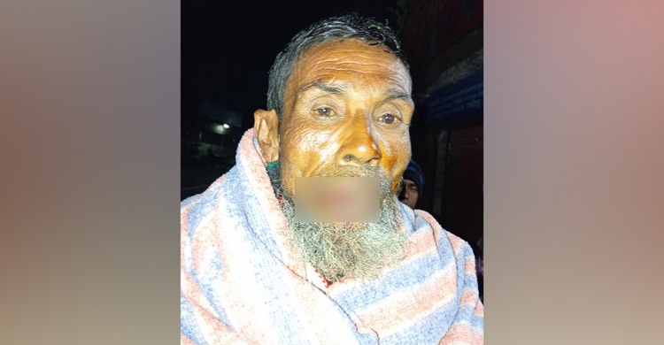 কমলনগরে চালককে মারধর করে অটোরিকশা ছিনতাইয়ের চেষ্টা